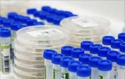 إعلان إصابة ثانية بأنفلونزا الخنازير في سورية