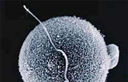 علماء يعلنون عن تخليق حيوانات منوية في المختبر