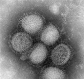 فيروس اتش1 ان1 يحدث اضرارا غير معتادة بالرئتين